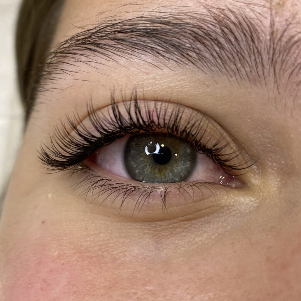 Podalševanje trepalnic v vuzenici